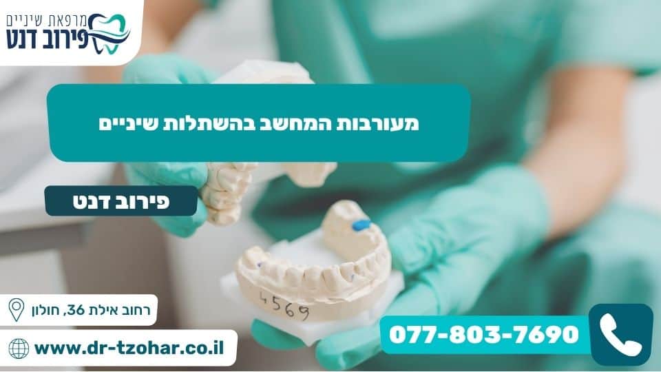 מעורבות המחשב בהשתלות שיניים