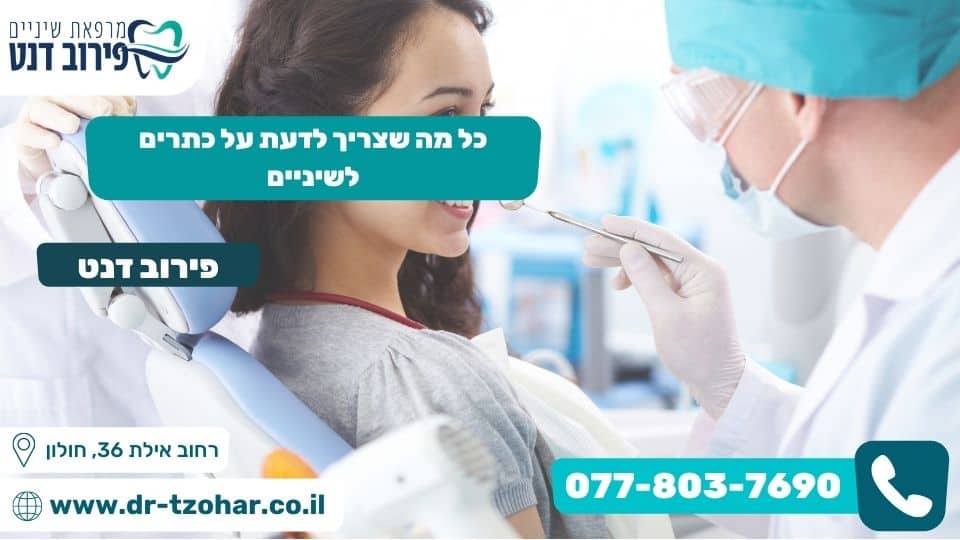 כל מה שצריך לדעת על כתרים לשיניים