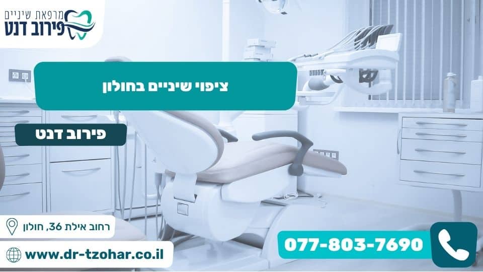 ציפוי שיניים בחולון