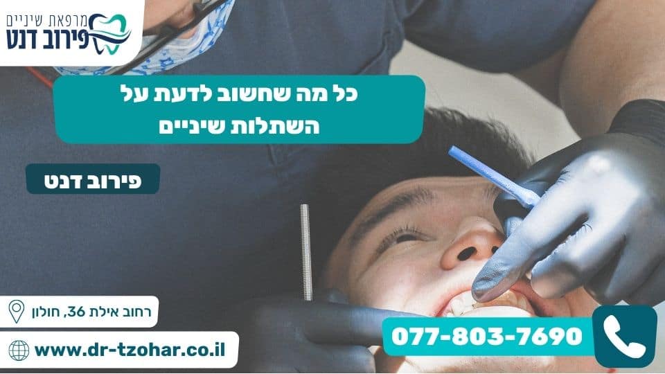 כל מה שחשוב לדעת על השתלות שיניים