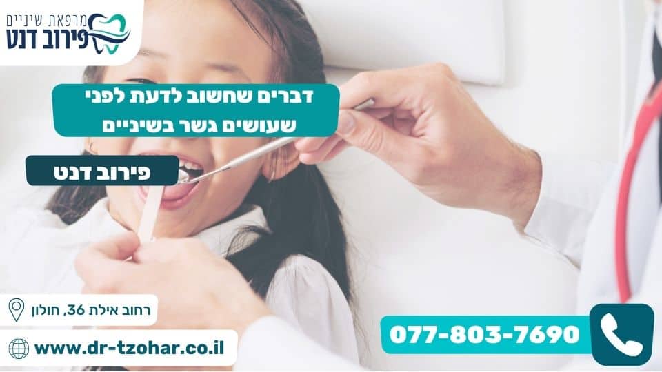 דברים שחשוב לדעת לפני שעושים גשר בשיניים