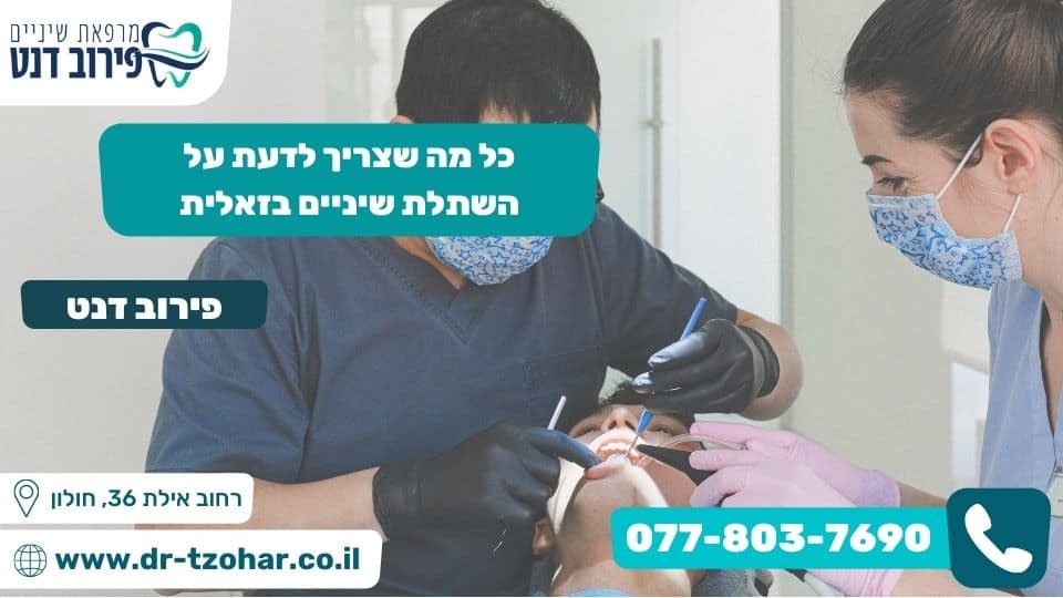 כל מה שצריך לדעת על השתלת שיניים בזאלית